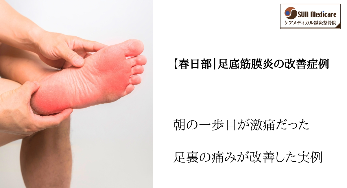 【春日部｜足底筋膜炎の改善症例 ケアメディカル鍼灸整骨院