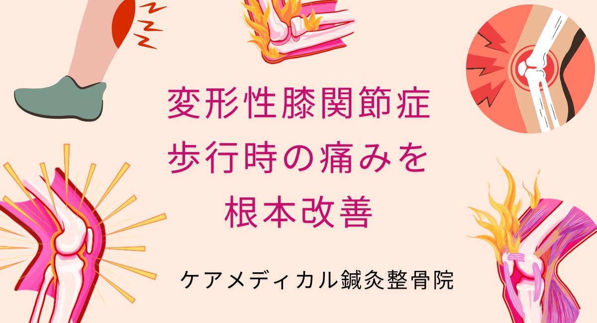 変形性膝関節症 歩行時の痛みを 根本改善